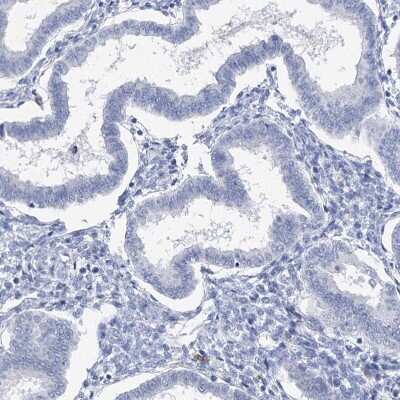 Immunohistochemistry-Paraffin: METTL7B Antibody [NBP2-47377]