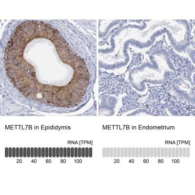 Immunohistochemistry-Paraffin: METTL7B Antibody [NBP2-47377]