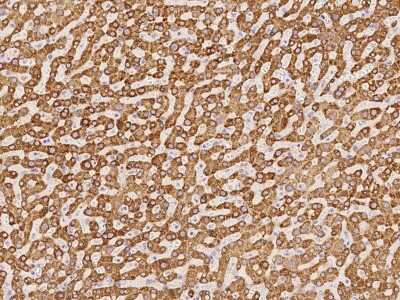 Immunohistochemistry-Paraffin: METTL7B Antibody [NBP2-97736]