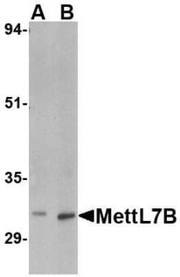 Western Blot: METTL7B AntibodyBSA Free [NBP1-76958]