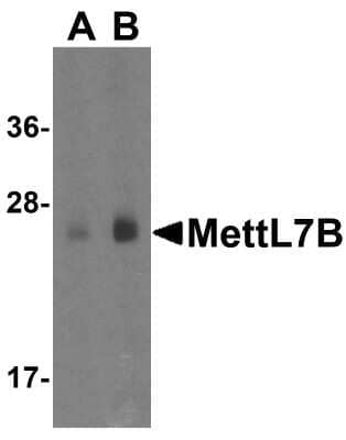 Western Blot: METTL7B AntibodyBSA Free [NBP1-77337]