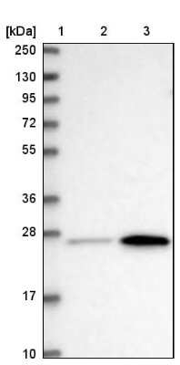 Western Blot: METTL7B Antibody [NBP2-47377]