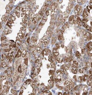 Immunohistochemistry-Paraffin: METTL8 Antibody [NBP1-94012]
