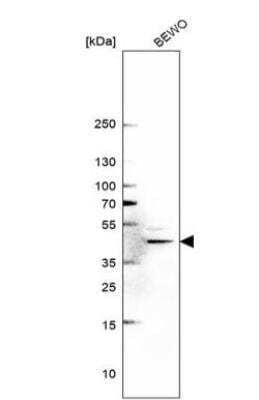 Western Blot: METTL8 Antibody [NBP1-94012]