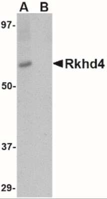 Western Blot: MEX3A AntibodyBSA Free [NBP2-41092]