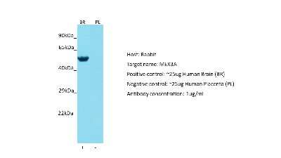 Western Blot: MEX3A Antibody [NBP2-85273]
