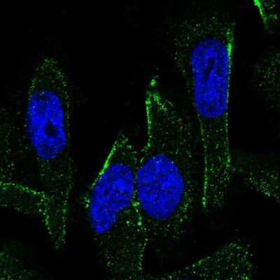 Immunocytochemistry/ Immunofluorescence: MEX3C Antibody [NBP1-81932]