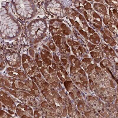 Immunohistochemistry-Paraffin: MEX3C Antibody [NBP1-81932]