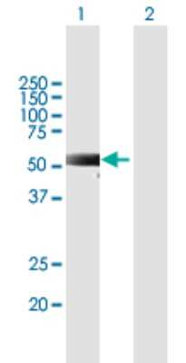 Western Blot: MEX3C Antibody [H00051320-B01P]