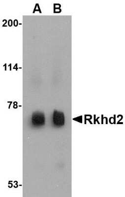 Western Blot: MEX3C AntibodyBSA Free [NBP1-76341]