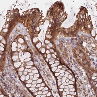 Immunohistochemistry: MEX3D Antibody [NBP2-39056]