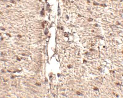 Immunohistochemistry-Paraffin: MEX3D Antibody - BSA Free [NBP1-77332]