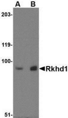 Western Blot: MEX3D AntibodyBSA Free [NBP1-77332]