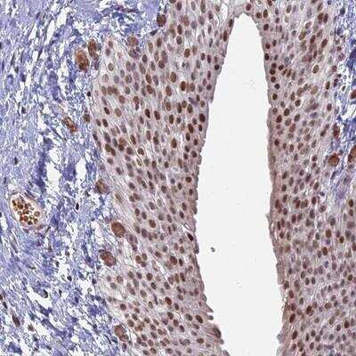 Immunohistochemistry-Paraffin: MFAP1 Antibody [NBP1-86217]