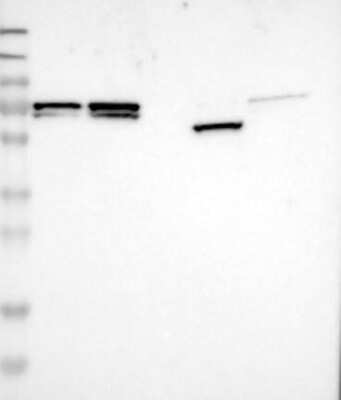 Western Blot: MFAP1 Antibody [NBP3-17517]