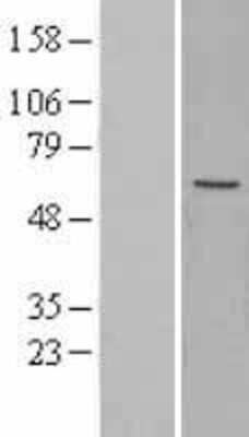 Western Blot: MFAP1 Overexpression Lysate [NBL1-13031]