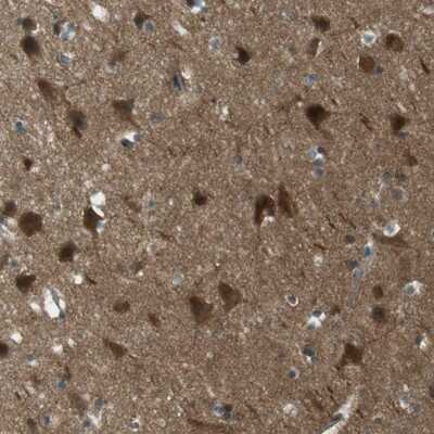 Immunohistochemistry-Paraffin: MFAP3 Antibody [NBP1-86067]