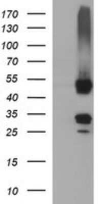 Western Blot: MFAP3 Antibody (OTI1B3)Azide and BSA Free [NBP2-72657]