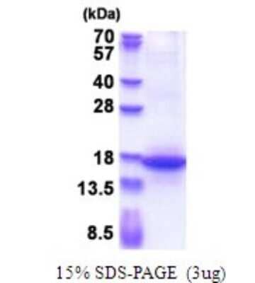 SDS-PAGE: Recombinant Human MFAP3 His Protein [NBP2-51669]