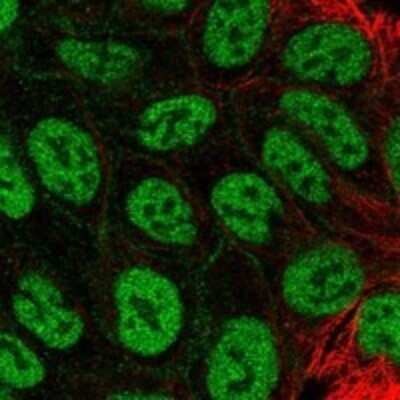 Immunocytochemistry/ Immunofluorescence: MFAP3L Antibody [NBP3-17518]