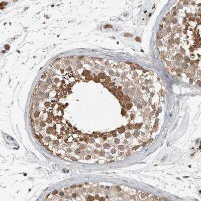 Immunohistochemistry-Paraffin: MFAP3L Antibody [NBP1-81494]