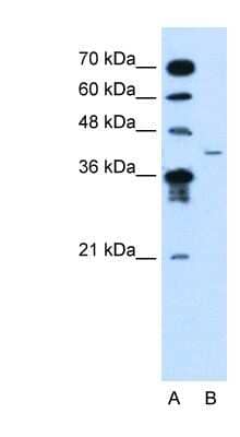 Western Blot: MFAP3L Antibody [NBP1-70637]