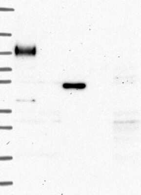 Western Blot: MFAP3L Antibody [NBP3-17518]