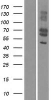 Western Blot: MFAP3L Overexpression Lysate [NBP2-06522]