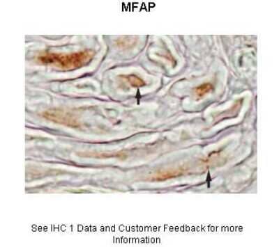 Immunohistochemistry: MFAP4 Antibody [NBP1-59158]