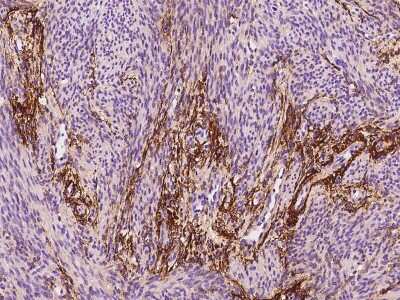 Immunohistochemistry-Paraffin: MFAP4 Antibody [NBP2-97485]