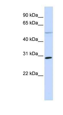 Western Blot: MFAP4 Antibody [NBP1-59158]