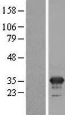 Western Blot: MFAP4 Overexpression Lysate [NBL1-13035]