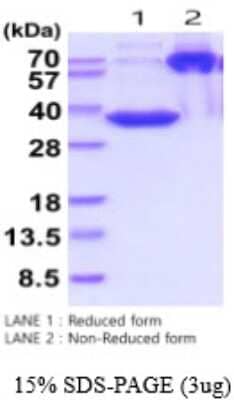 SDS-PAGE: Recombinant Human MFAP4 His Protein [NBP2-53073]