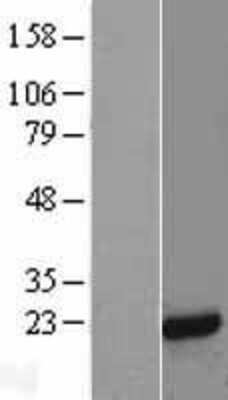 Western Blot: MAGP-2/MFAP5 Overexpression Lysate [NBL1-13036]