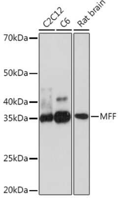 Western Blot: MFF Antibody (5U5S4) [NBP3-16683]