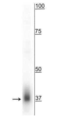 Western Blot: MFF Antibody [NBP3-11947]