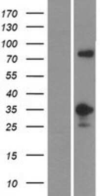 Western Blot: MFF Overexpression Lysate [NBP2-06682]