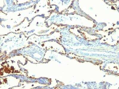 Immunohistochemistry-Paraffin: MFG-E8 Antibody (SPM291) - IHC-Prediluted [NBP2-48260]