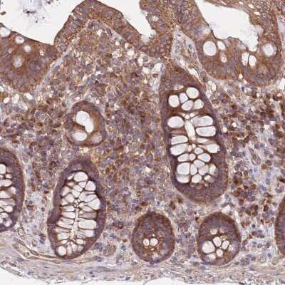 Immunohistochemistry-Paraffin: MFNG Antibody [NBP2-14234]