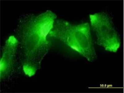 Immunocytochemistry/ Immunofluorescence: MFRP Antibody (1E12) [H00083552-M01]