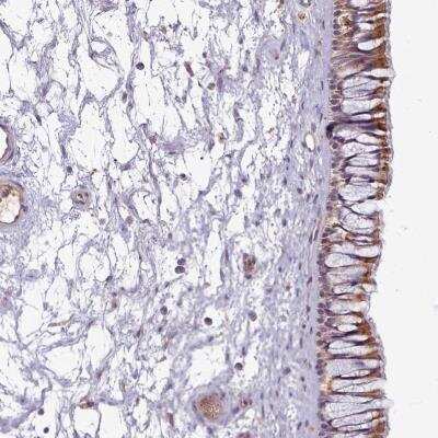 Immunohistochemistry: C1qTNF5/CTRP5 Antibody [NBP2-34052]