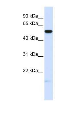 Western Blot: MFRP Antibody [NBP1-59568]