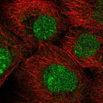 Immunocytochemistry/ Immunofluorescence: MFSD1 Antibody [NBP2-58234]