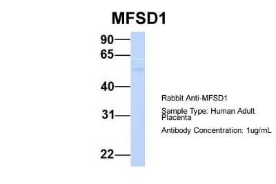 Western Blot: MFSD1 Antibody [NBP1-59624]