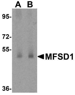 Western Blot: MFSD1 AntibodyBSA Free [NBP1-76488]