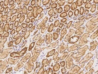 Immunohistochemistry: MFSD11 Antibody [NBP3-06336]