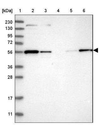 Western Blot: MFSD11 Antibody [NBP1-93984]
