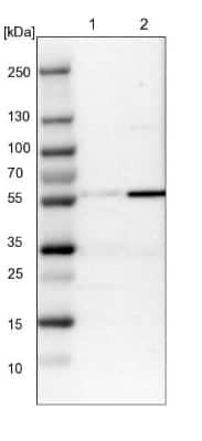 Western Blot: MFSD11 Antibody [NBP1-93984]