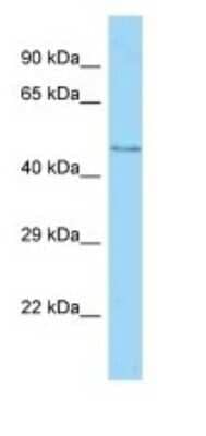 Western Blot: MFSD11 Antibody [NBP1-98393]