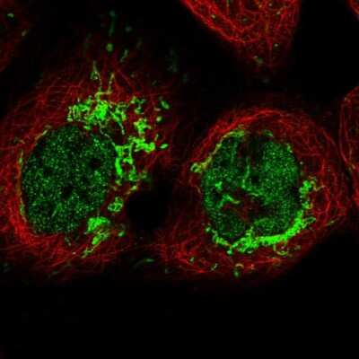 Immunocytochemistry/ Immunofluorescence: MFSD12 Antibody [NBP2-47376]